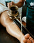 Dhanyamla Dhara treatment.