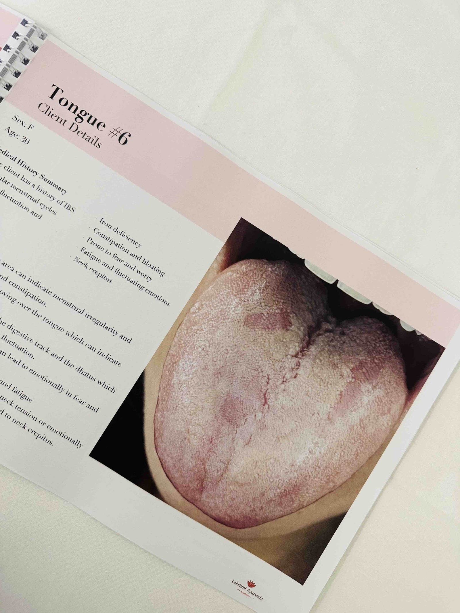 Tongue Analysis EBook